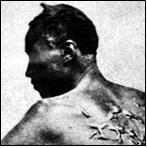 A Slave with scars from a whipping, April 2, 1863