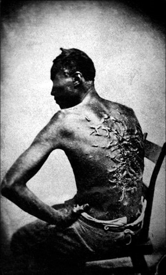 A Slave with scars from a whipping, April 2, 1863